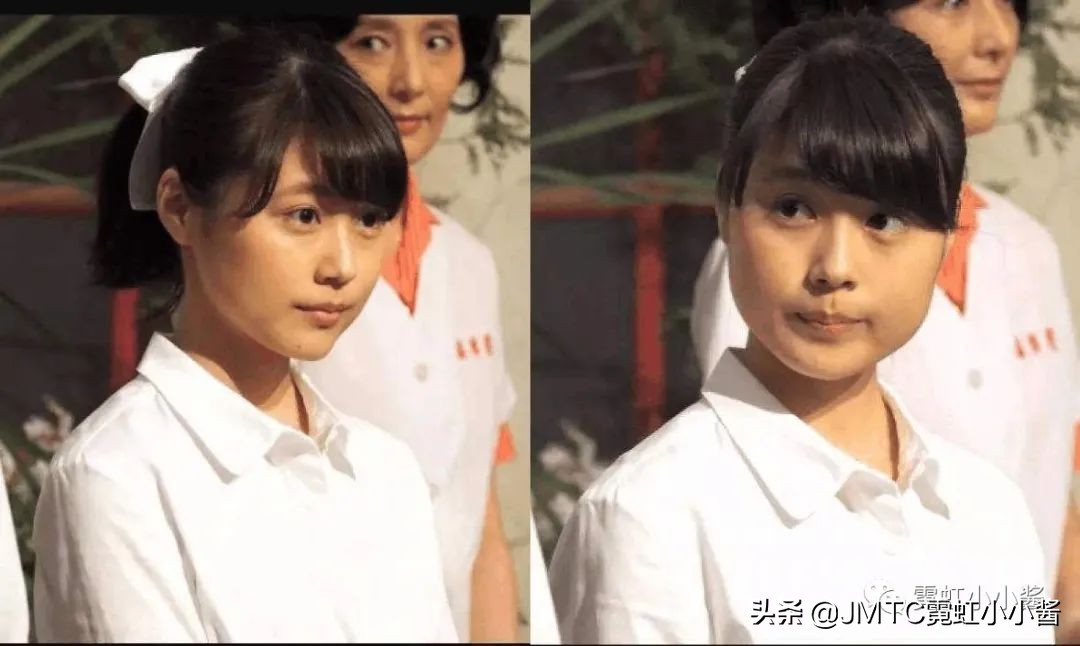 25岁抗老拯救垮脸,哪种脸型抗衰抗皱