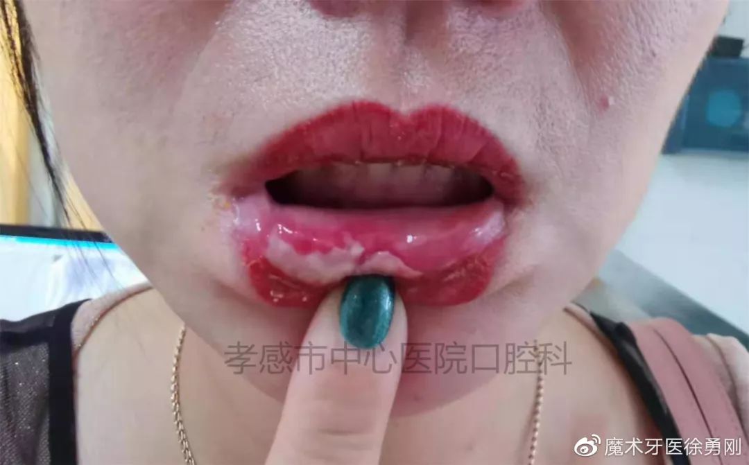 内行人为什么不建议漂唇,作为一名医生一直被人质疑