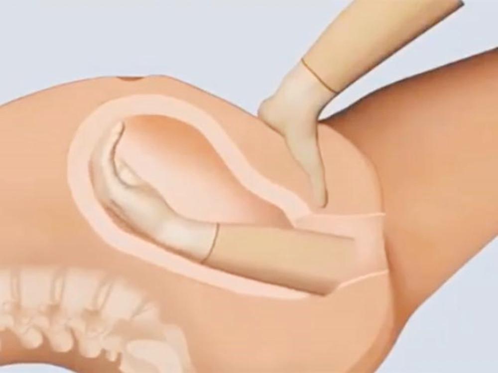 生孩子时女性骨盆的变化,生孩子产道会扩张到多少cm