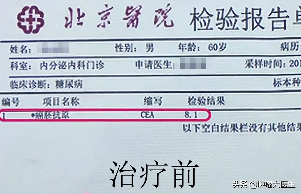 顽固息肉切了又生？中医标本兼治搞定它