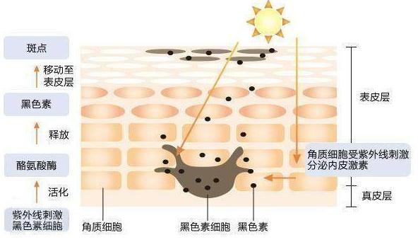 脖子被太阳晒黑了怎么才能变白,被太阳晒黑怎样变白女生