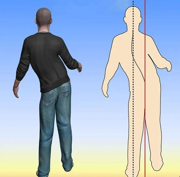 56岁男子深夜脑出血，提醒：这把年纪了，怎么还做这2件事