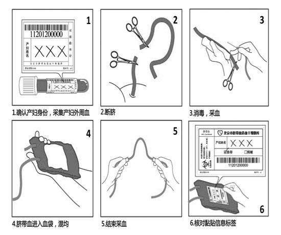 脐带血商业用途,脐带血保存的靠谱公司