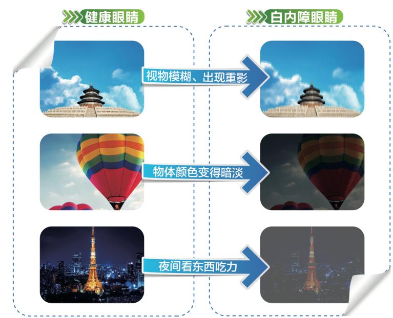 胶南高度近视白内障手术,烟台毓璜顶眼科白内障哪个大夫好