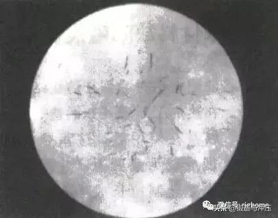 锻件白点怎么形成,钢中白点缺陷原因