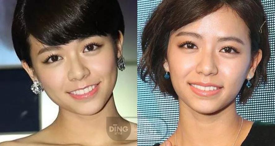 戴牙套凸嘴怎么化妆,凸嘴整牙削骨吗