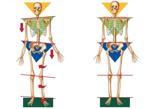 跑步时脚是外八字怎么纠正,膝盖内扣脚外八字跑步