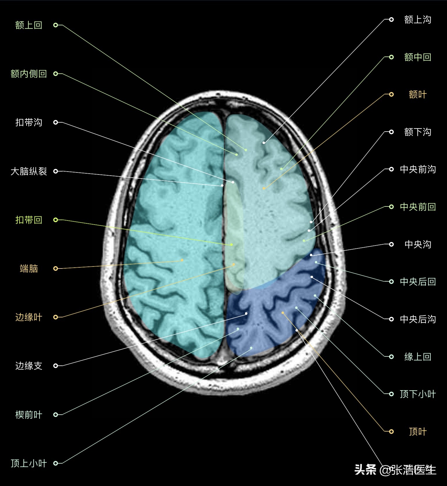颅脑mri断层解剖视频课件,颅脑mri解剖手绘图