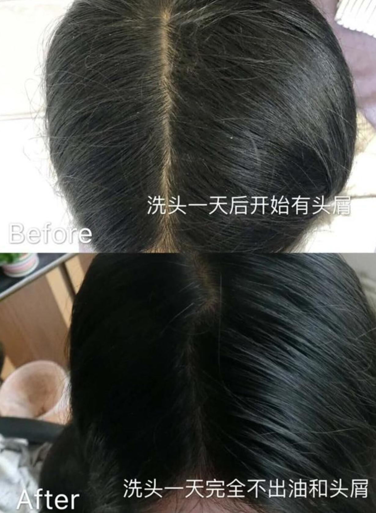 海飞丝洗发水与飘柔洗发水相比,飘柔洗发水和海飞丝洗发水哪个好