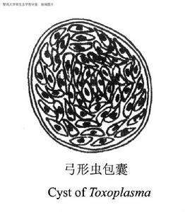 弓形虫孕期查完后感染怎么办,优生优育五项检查弓形虫数值