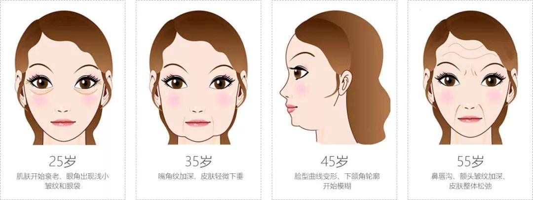 女明星每天注射玻尿酸,女明星都打玻尿酸吗