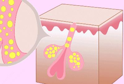 城野医生毛孔细致水去闭口吗,城野医生毛孔细致水一周用几次