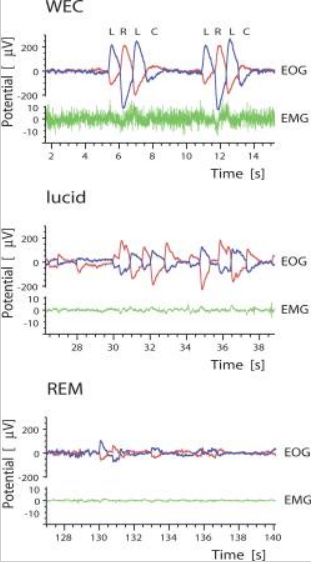 斯坦福博士告诉你：清醒梦*行为性**真的存在吗？