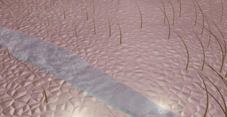 怎么恢复愈合伤口留下的疤痕,科普短片伤口是如何愈合的