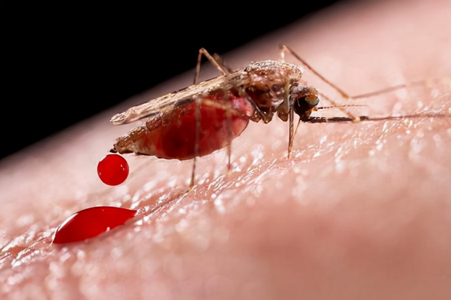 蚊虫叮咬教您几招止痒简单又快速,蚊虫叮咬怎么止痒最快最有效