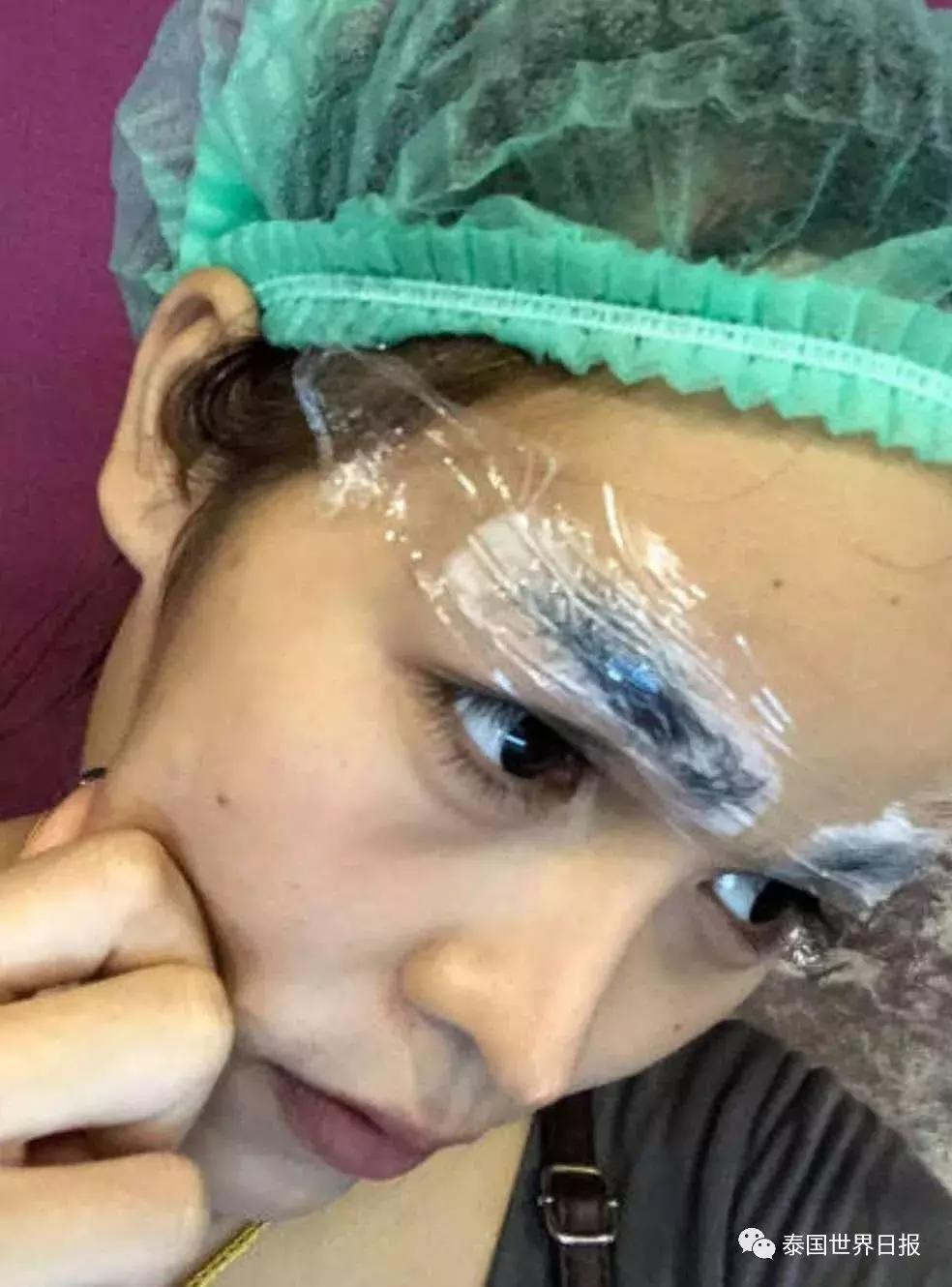 泰国网红Pond妹5年整容史:隆鼻、纹眉、凸魔唇