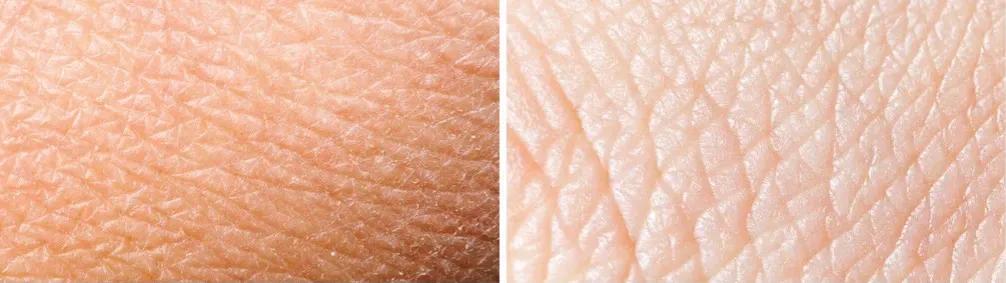 乳液和面霜的区别图解,乳液和面霜的先后顺序