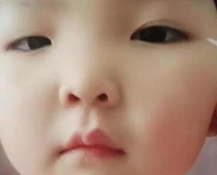 小孩怎样才能弄成双眼皮,怎么在家给孩子制作自然的双眼皮