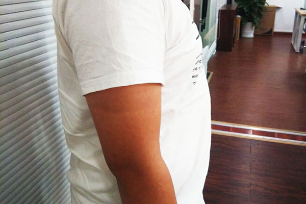 得了滑膜炎怎样锻炼恢复,得了滑膜炎怎么锻炼好