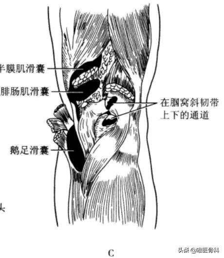 膝盖后面有个鼓鼓的包是不是病,膝盖后面有个包怎么回事