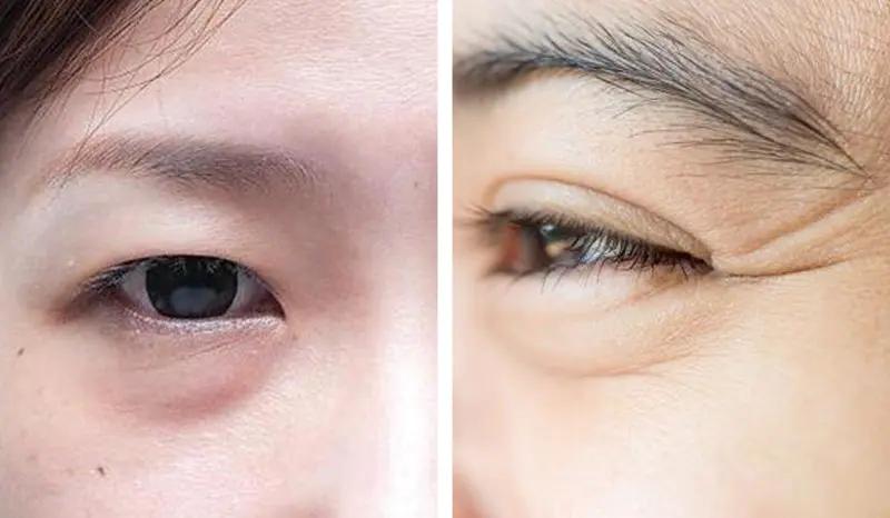 comper美容仪是智商税吗,美容仪哪一个最好用不是智商税