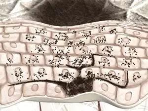 目前治疗褐青斑的最好方法,治疗褐斑最好的药