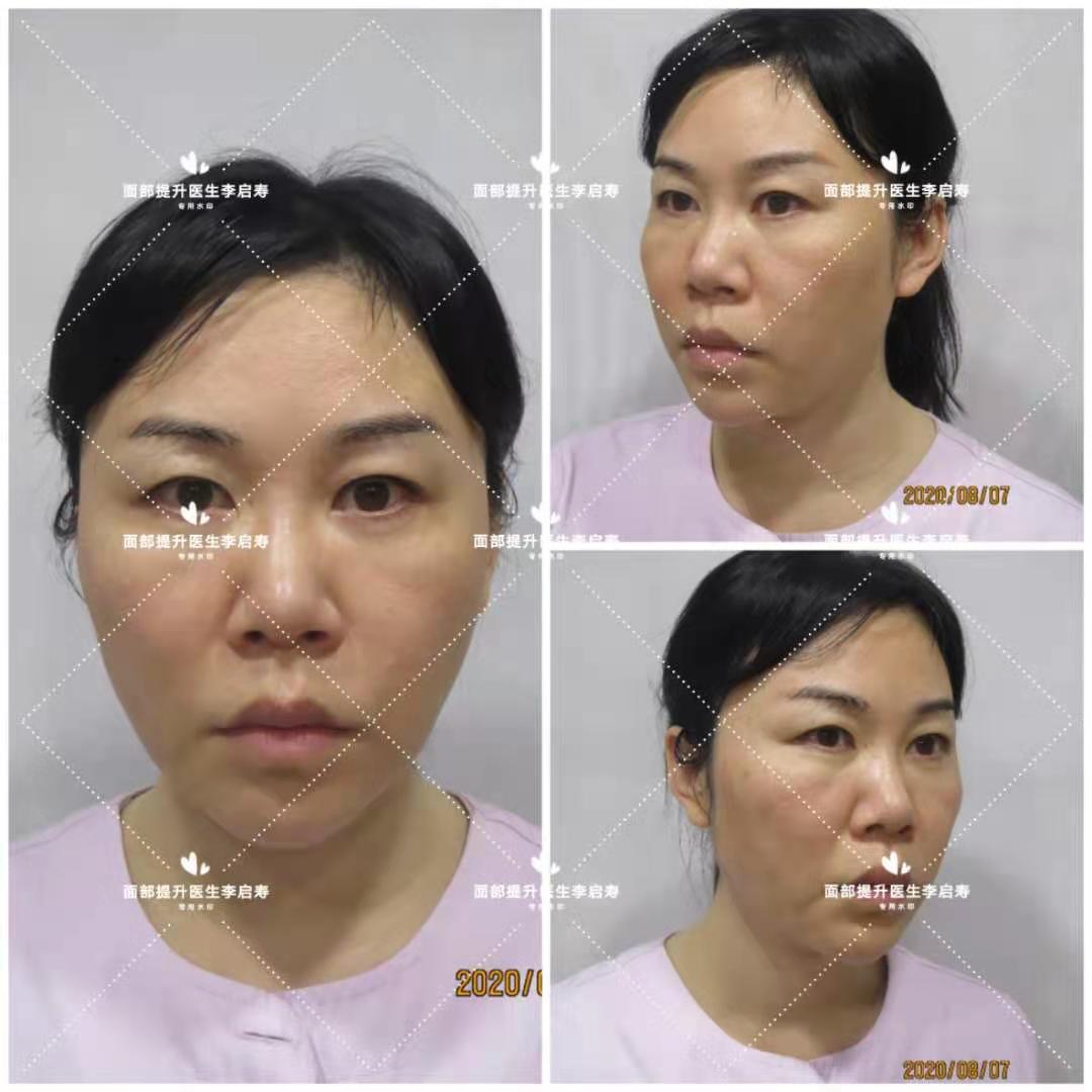 长脸型怎么让脸胖点,长脸型怎么改善变好看