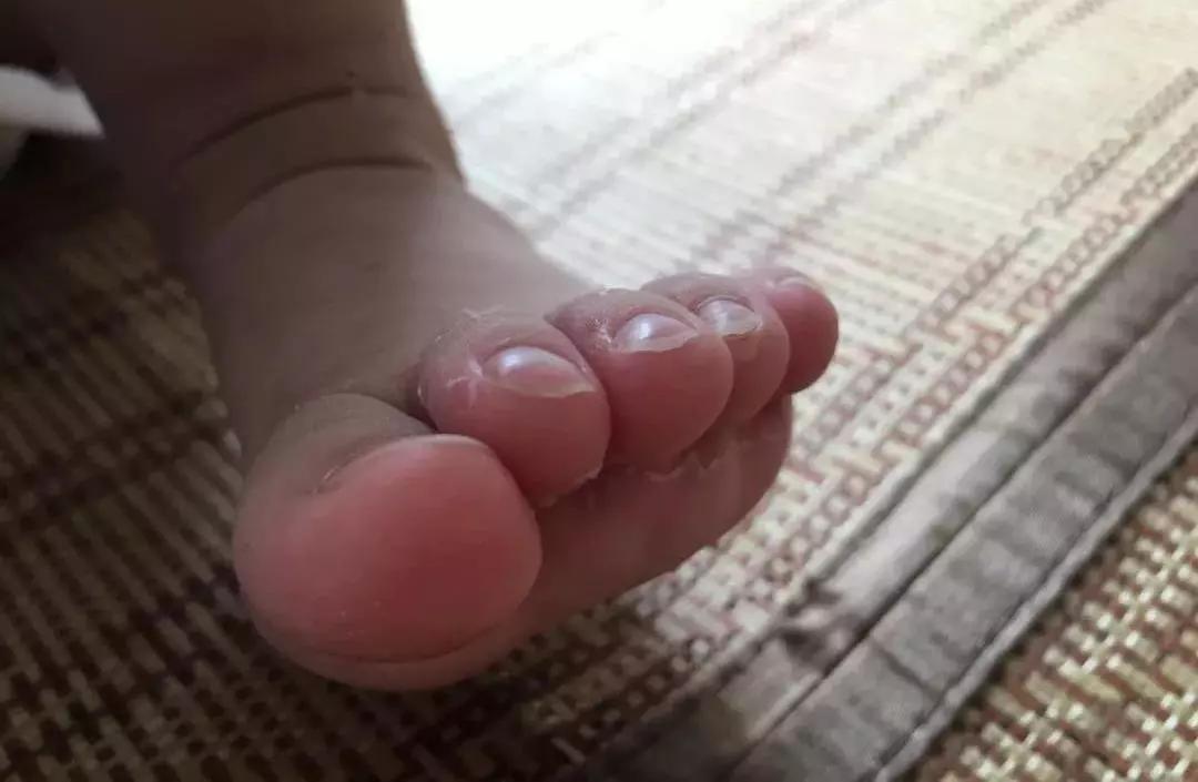 再也不怕当众脱鞋了，给你看看我的防臭法宝