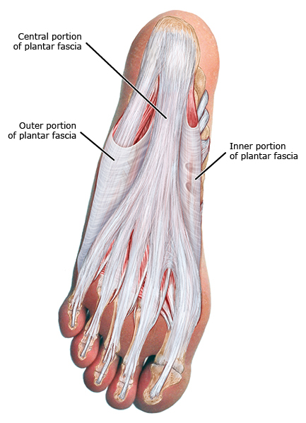 「足底筋膜炎」？所有你想知道的，应该知道的，都在这里了