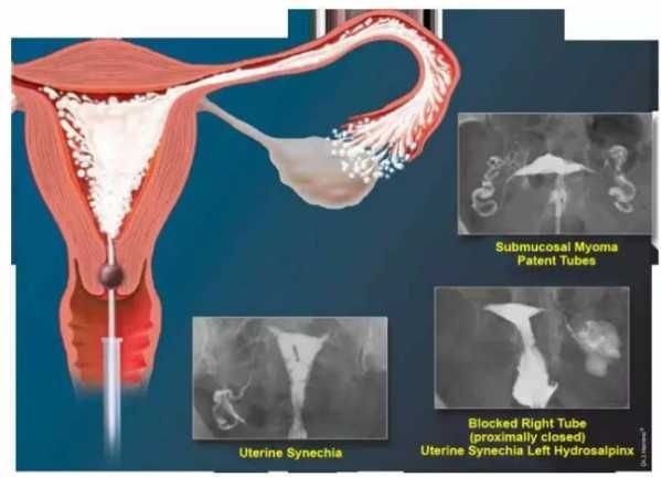一年一次的妇科检查，提前做好这些准备，体检过程事半功倍！