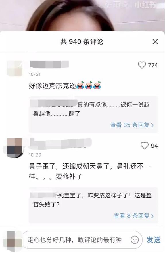 张雨绮回应鼻子一大一小不对称,张雨绮现在的鼻子怎么了