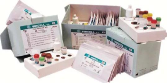 儿童喘息性支气管炎中医诊疗方案,喘息性支气管炎诊疗分析