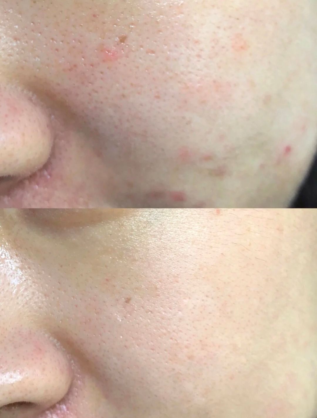 你的洗面奶上排名了吗,哪几种洗面奶上黑名单