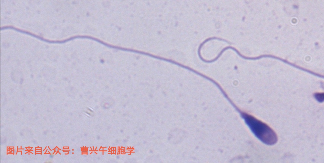 男科诊疗纪实,男科专家谈精子系列