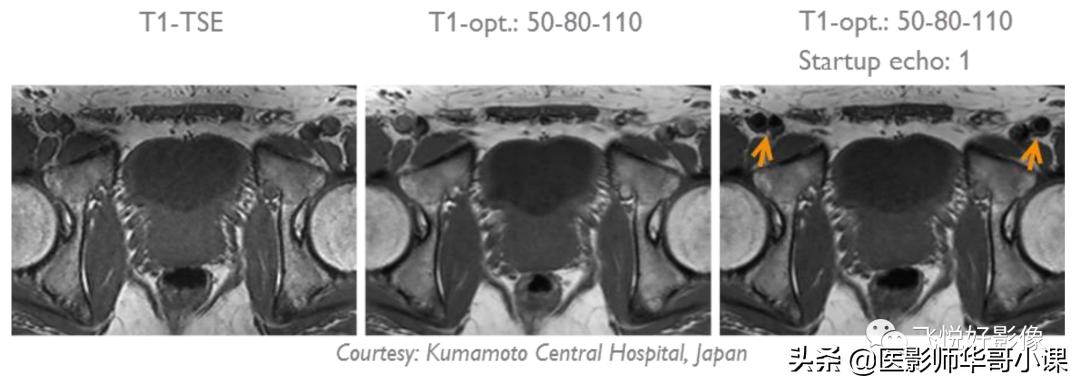 飞利浦磁共振波谱扫描方案,飞利浦1.5t磁共振mri操作使用手册