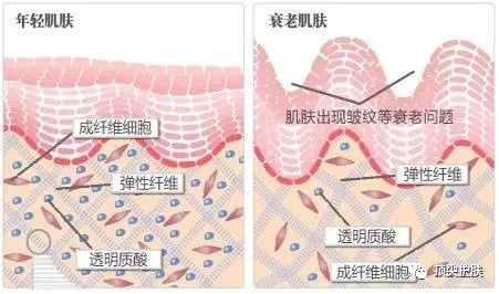 射频仪器对人体的伤害,射频仪危害
