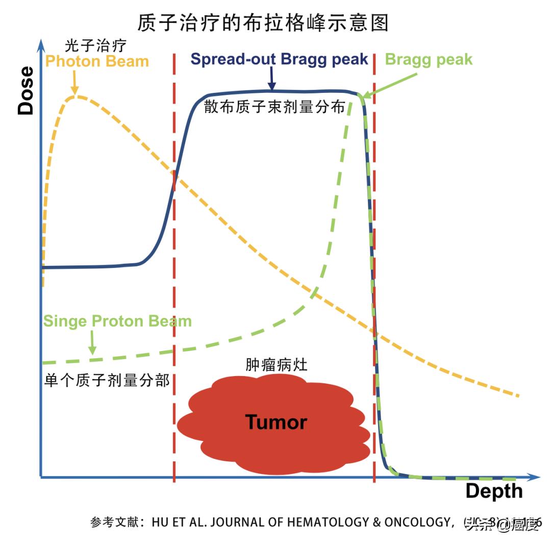 质子治疗能彻底治愈癌症吗,质子治疗靠什么杀死癌细胞