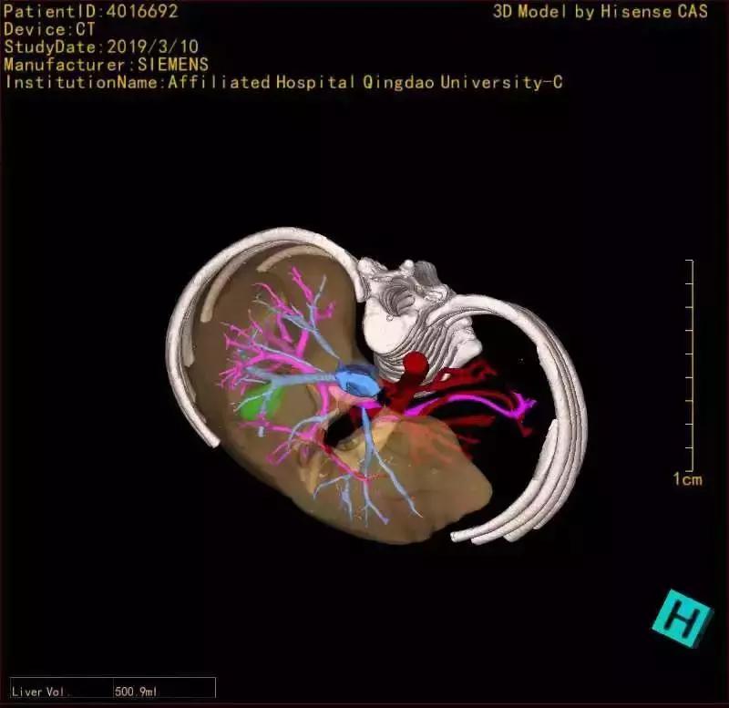青岛4岁男童死亡,青岛4岁男孩车祸去世