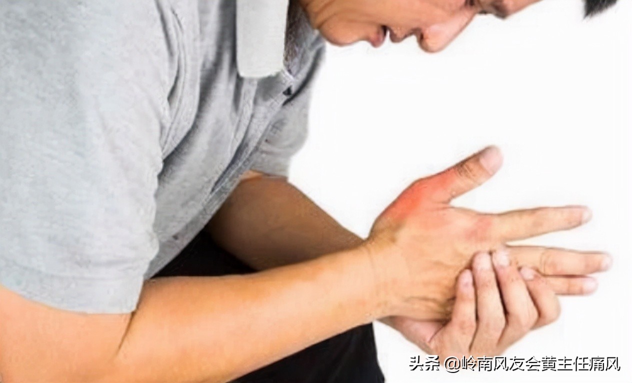 肌酐和尿酸都偏高饮食注意些什么,孩子尿酸偏高控制饮食有恢复的吗