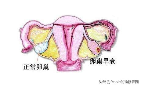 经常生闷气怎么做瑜伽,对子宫卵巢有帮助的瑜伽动作