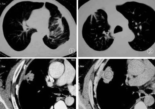 x线诊断边界模糊,x线诊断有误区吗