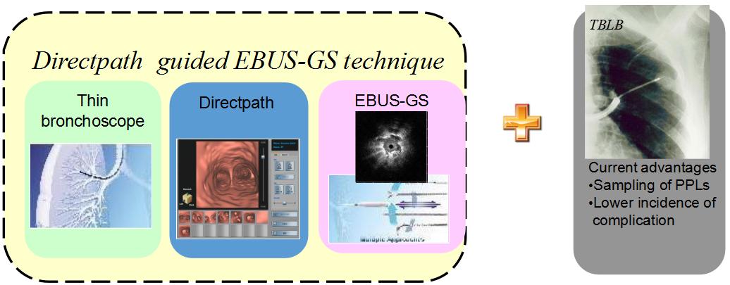 孙加源门诊,治疗肺癌的新技术新手段