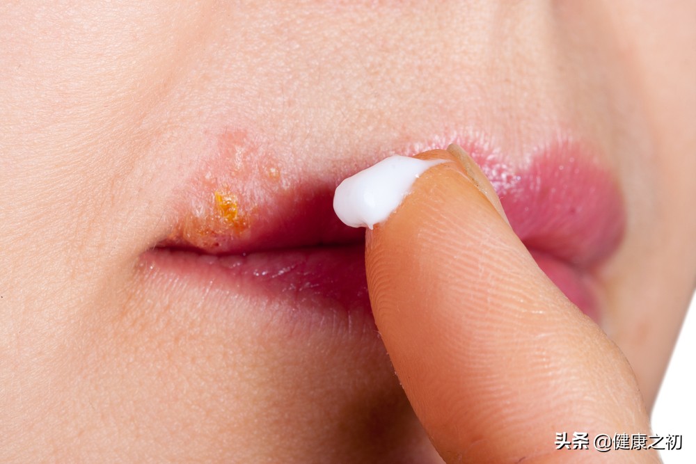 嘴唇红肿是不是上火,嘴唇发红干裂说明什么