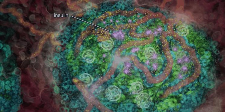 胰岛素是如何导致糖尿病的,胰岛素增多为什么会导致糖尿病