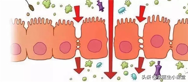 甲状腺结节吃什么药才能散结,甲状腺囊实性结节吃啥药能散结