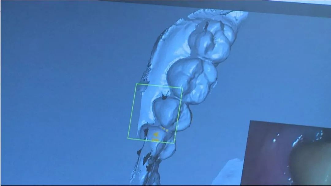 人民苏口,放心口碑!-《百年苏口大揭秘》(下)