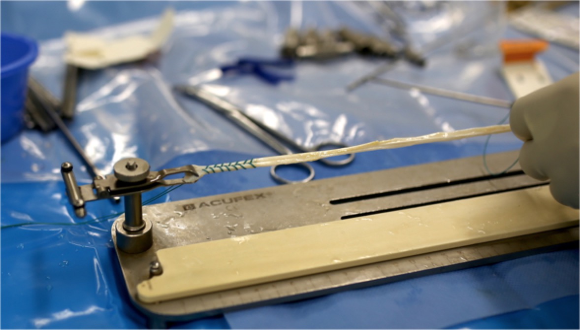 膝关节前交叉韧带修复后如何康复,前交叉韧带重建后膝盖发软