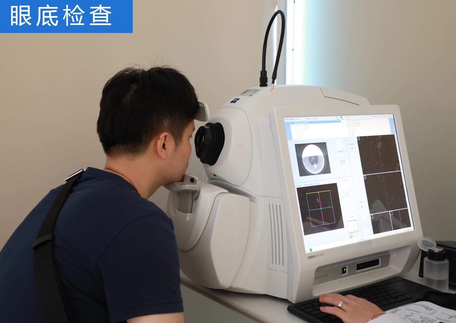 眼睛近视了做手术有什么注意事项,眼睛近视做激光手术需要注意什么