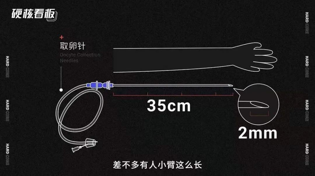 郑爽三次发文代孕事件的真相