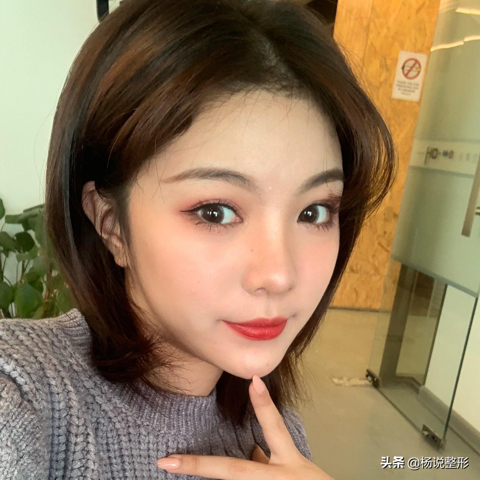 28岁做线雕提升脸部好不好,28岁女人做线雕现状